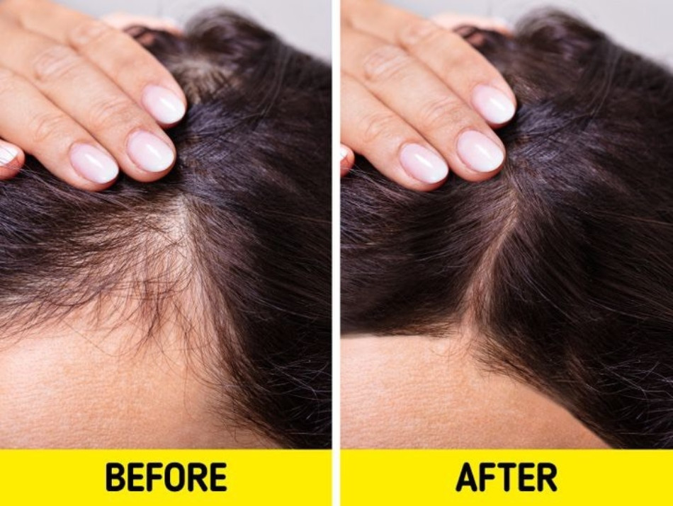 10 Cách Chăm Sóc Tóc Bằng Dầu Dừa Hiệu Quả Giúp Tóc Mọc Nhanh, Mềm Mại