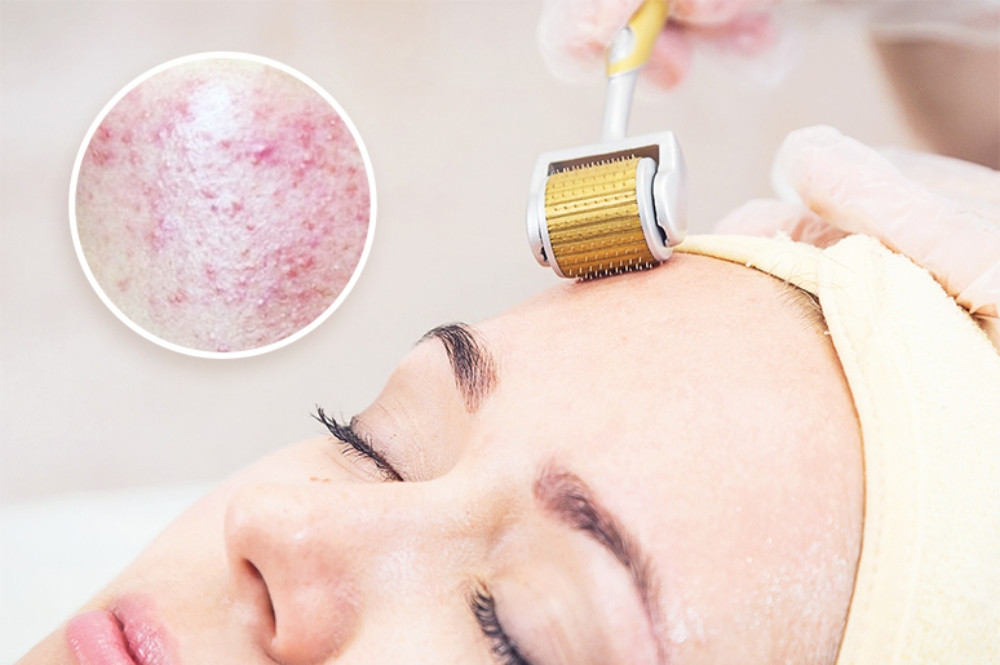 11 Dụng Cụ Chăm Sóc Da Mặt Cần Thiết Cho Phái Đẹp
