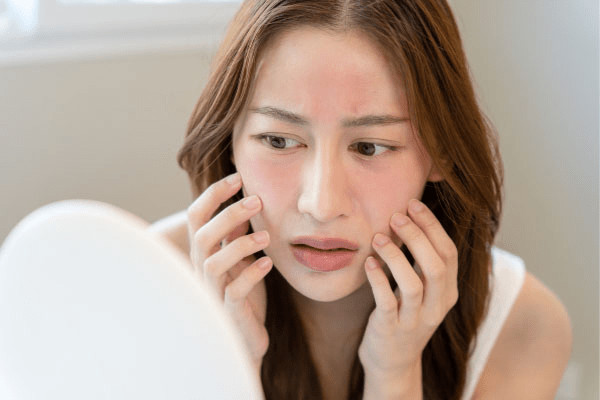 15 Cách Giữ Ẩm Cho Da Mặt Hiệu Quả Từ Thiên Nhiên