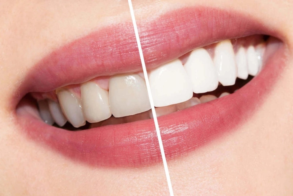18 Cách Để Xinh Đẹp Mà Không Cần Trang Điểm