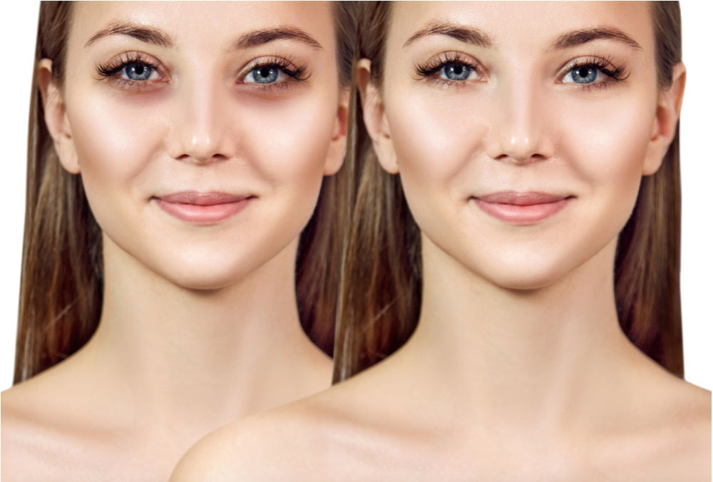18 Cách Để Xinh Đẹp Mà Không Cần Trang Điểm