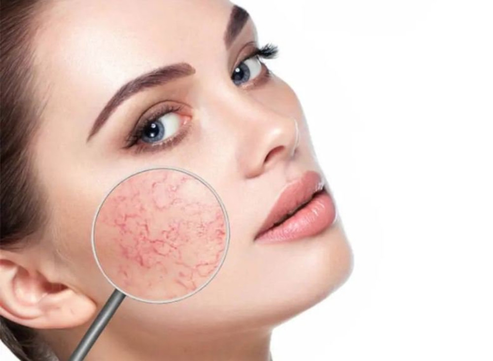 8 Cách Chăm Sóc Da Yếu Mỏng Nhanh Chóng Tái Tạo Sức Khỏe