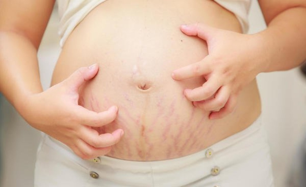 8 cách chăm sóc làm đẹp da mặt sau sinh hiệu quả tại nhà