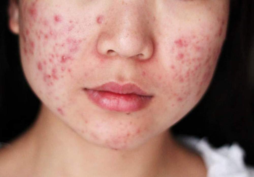 8 cách chăm sóc làm đẹp da mặt sau sinh hiệu quả tại nhà