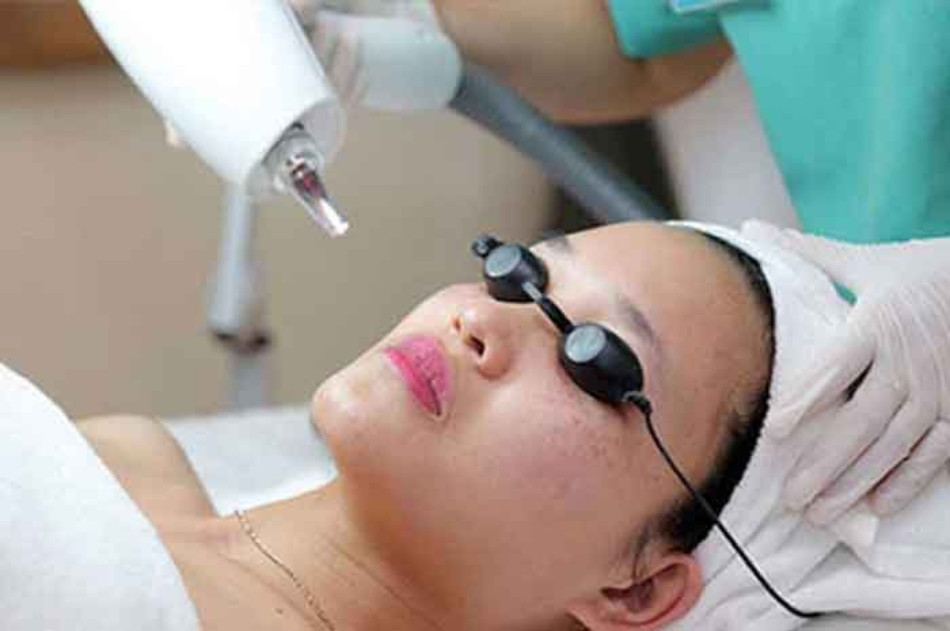 8 nguyên nhân gây nám tàn nhang và cách phòng ngừa hiệu quả