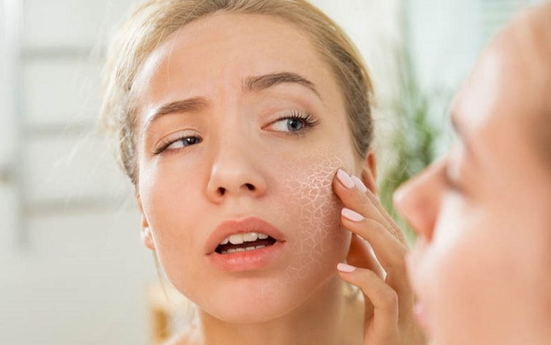 9 bước skincare cho da khô lỗ chân lông to đầy đủ và hiệu quả nhất