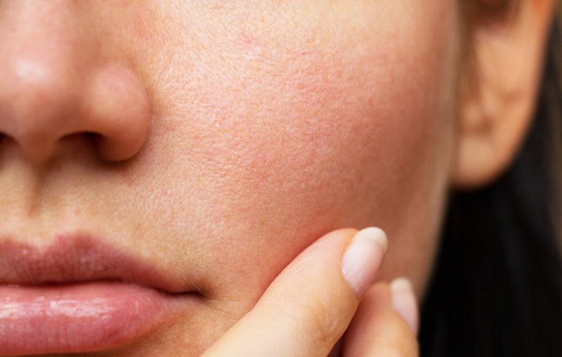 9 bước skincare cho da khô lỗ chân lông to đầy đủ và hiệu quả nhất