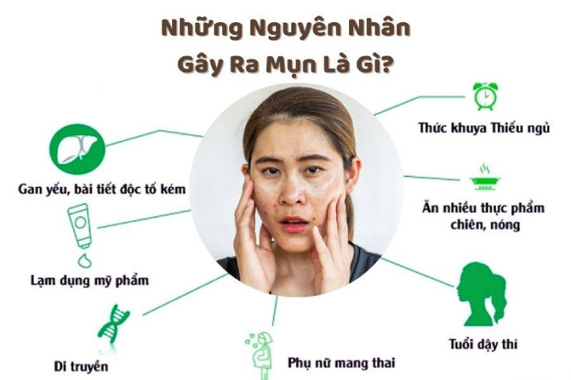 Cách Chăm Sóc Da Dầu Mụn Hiệu Quả: 8 Bước Đơn Giản Giúp Phục Hồi Nhanh Chóng
