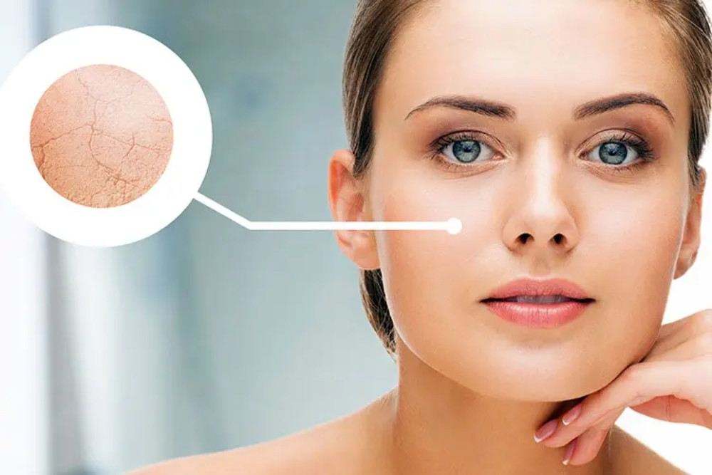 Cách Chăm Sóc Da Khô Để Duy Trì Độ Ẩm Và Sức Sống