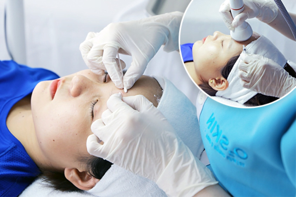 Cách chăm sóc da mặt bị mụn ẩn đơn giản, hiệu quả tại nhà 