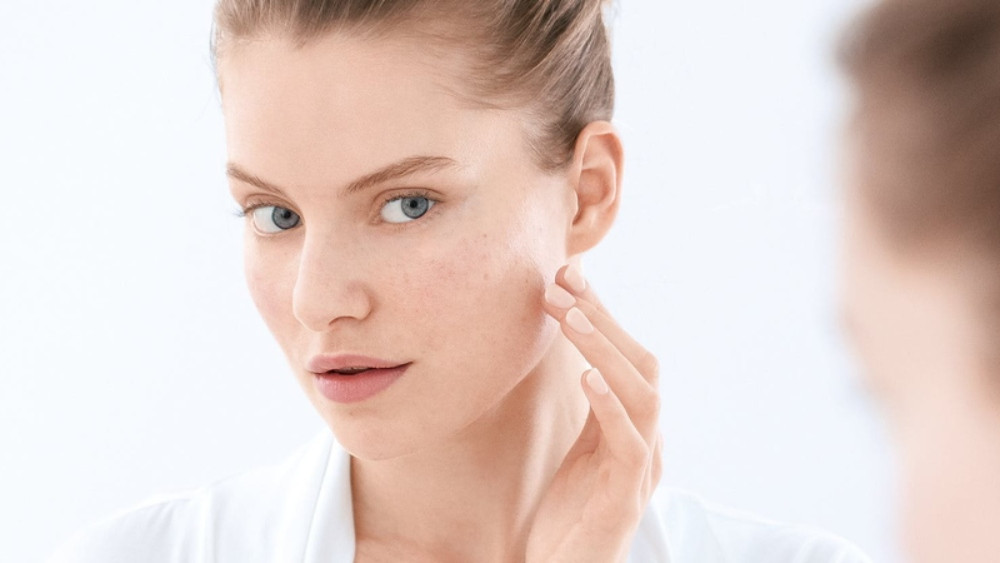 Cách chăm sóc da mặt bị mụn ẩn đơn giản, hiệu quả tại nhà 