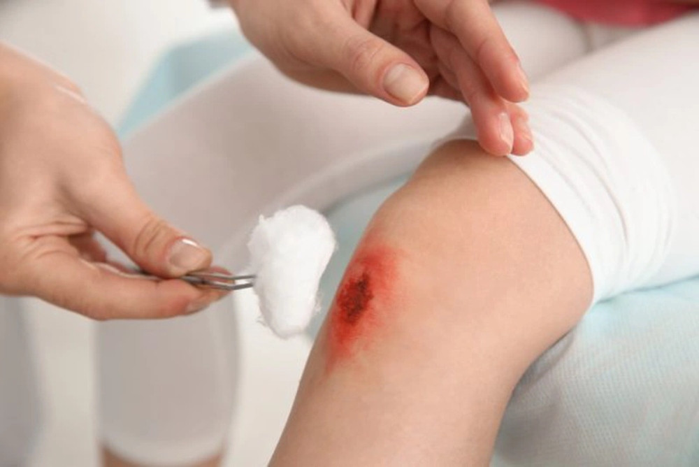 Cách chăm sóc vết thương không để lại sẹo mà bạn cần biết