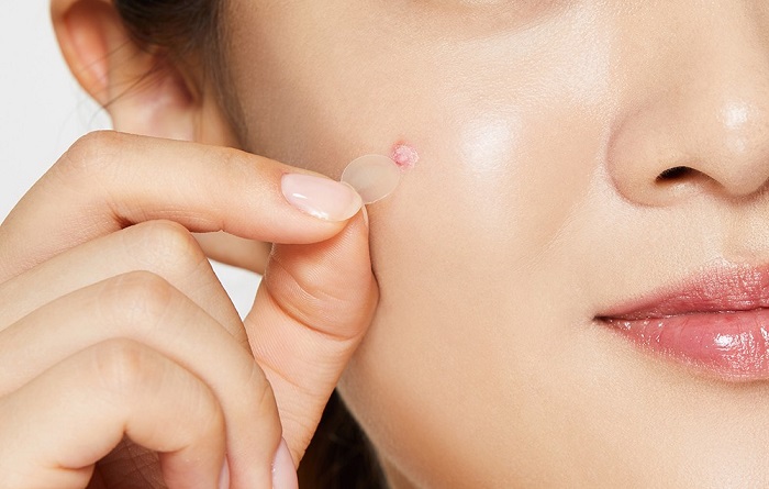 Chia sẻ cách trang điểm che mụn tốt nhất hiện nay