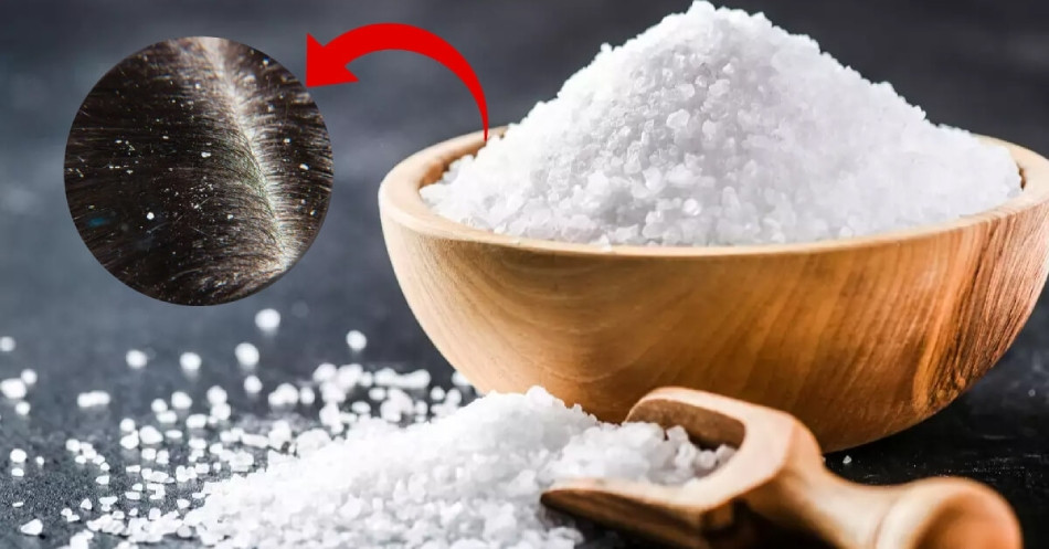 Gàu ống có lây không? 9 nguyên nhân thực sự gây ra gàu ống