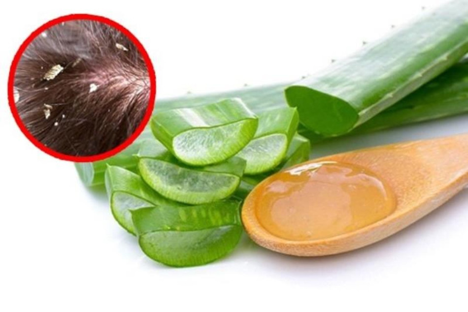 Gàu ống có lây không? 9 nguyên nhân thực sự gây ra gàu ống