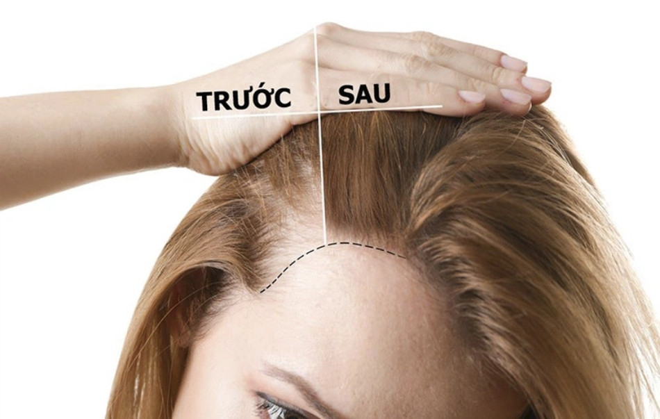 [Giải đáp chuyên gia] Gội đầu nhiều có mọc tóc nhanh không?