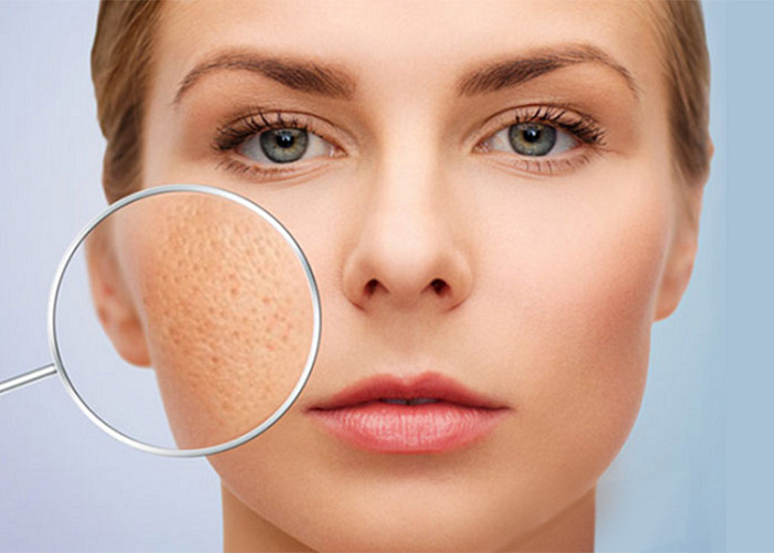 Hiểu về sẹo: Nguyên nhân, loại sẹo và cách điều trị hiệu quả