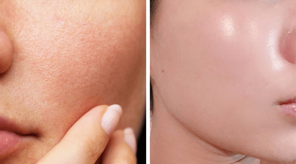 Hướng dẫn cách sử dụng kem dưỡng da từ A đến Z đúng chuẩn