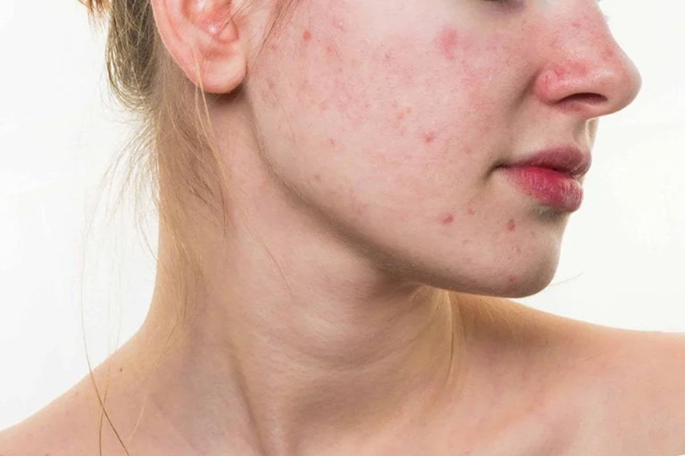 Khám Phá 7 Tác Dụng Tuyệt Vời Của Nghệ Và Mật Ong Trong Làm Đẹp