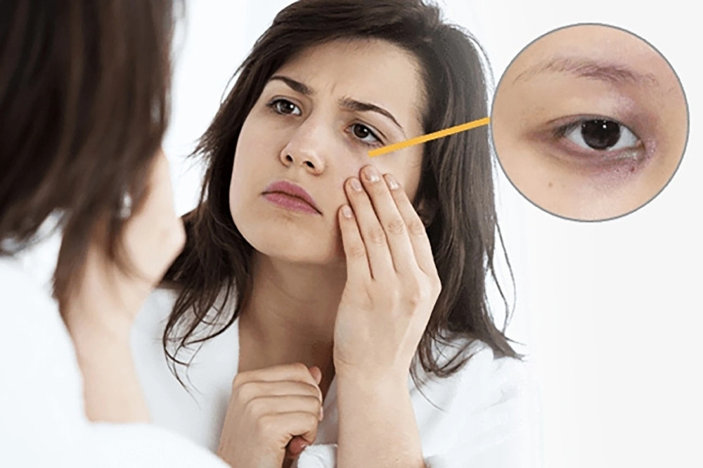 Khám Phá 7 Tác Dụng Tuyệt Vời Của Nghệ Và Mật Ong Trong Làm Đẹp