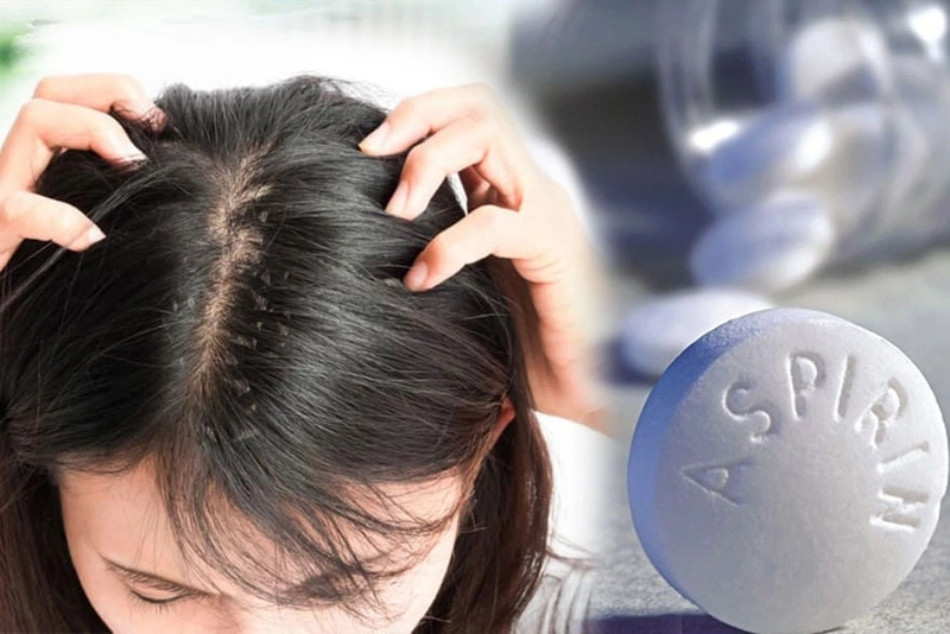 Mẹo 15 cách trị hết gàu TẬN GỐC cực nhanh và đơn giản tại nhà