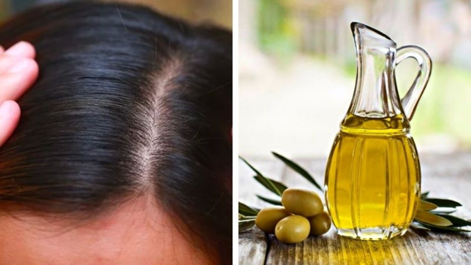 Mẹo 15 cách trị hết gàu TẬN GỐC cực nhanh và đơn giản tại nhà