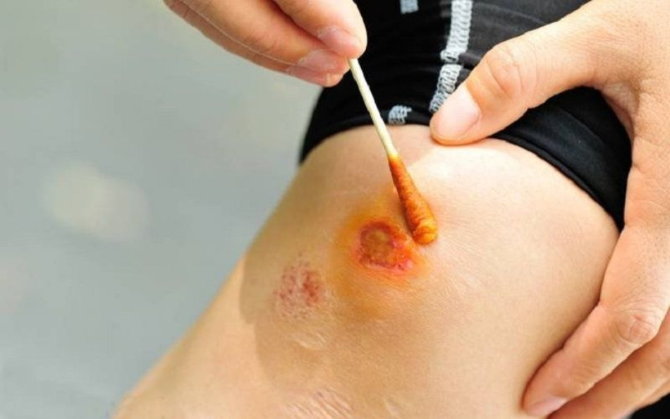 Nghệ: Có Làm Trắng Da Không? Khám Phá 10 Cách Làm Trắng Da Từ Nghệ Hiệu Quả