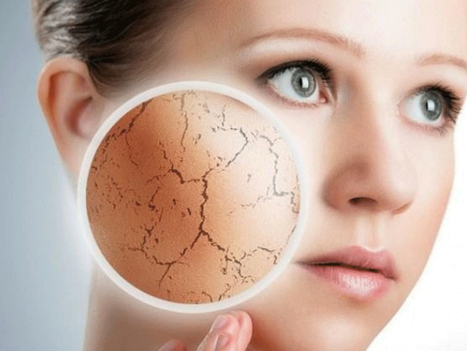 Nước Hoa Hồng: Cách Sử Dụng Đúng Để Mang Lại Lợi Ích Tối Đa Cho Da