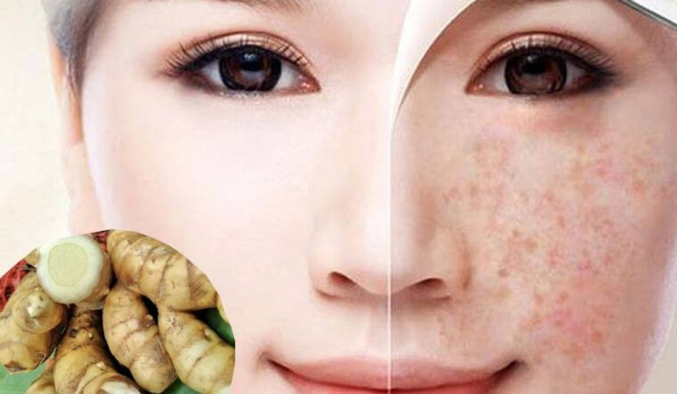 Tác Dụng Của Nghệ Trắng Trong Làm Đẹp Mà Bạn Chưa Biết