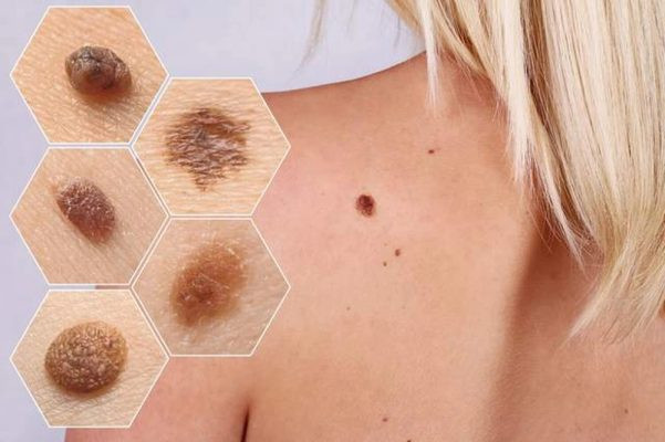 Tìm hiểu 11 công dụng của kem chống nắng bảo vệ da hằng ngày