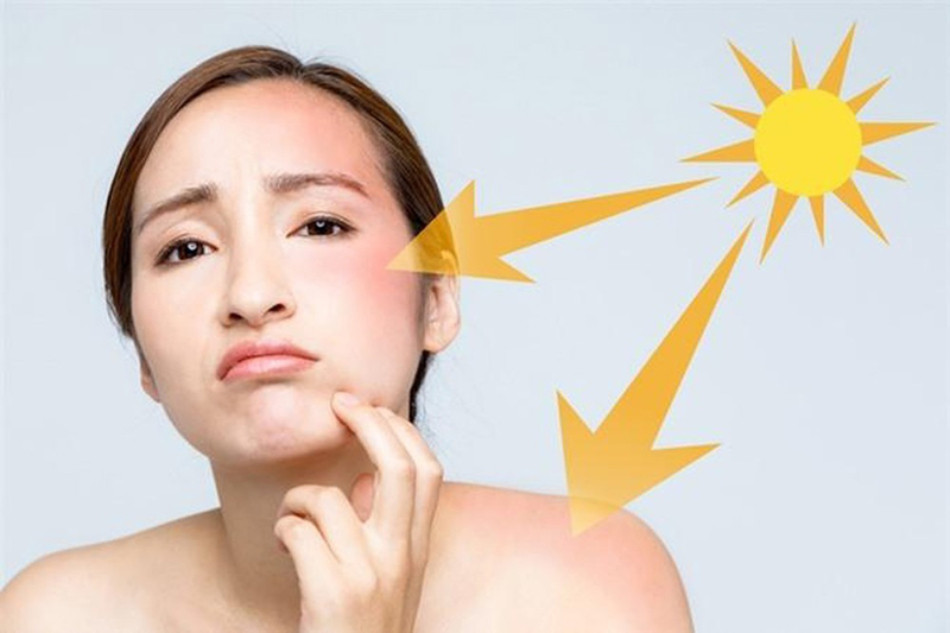Top 13 Kem Chống Nắng Collagen Dưỡng Da Cao Cấp, Tươi Trẻ Từ MyPhamLinhNham.vn