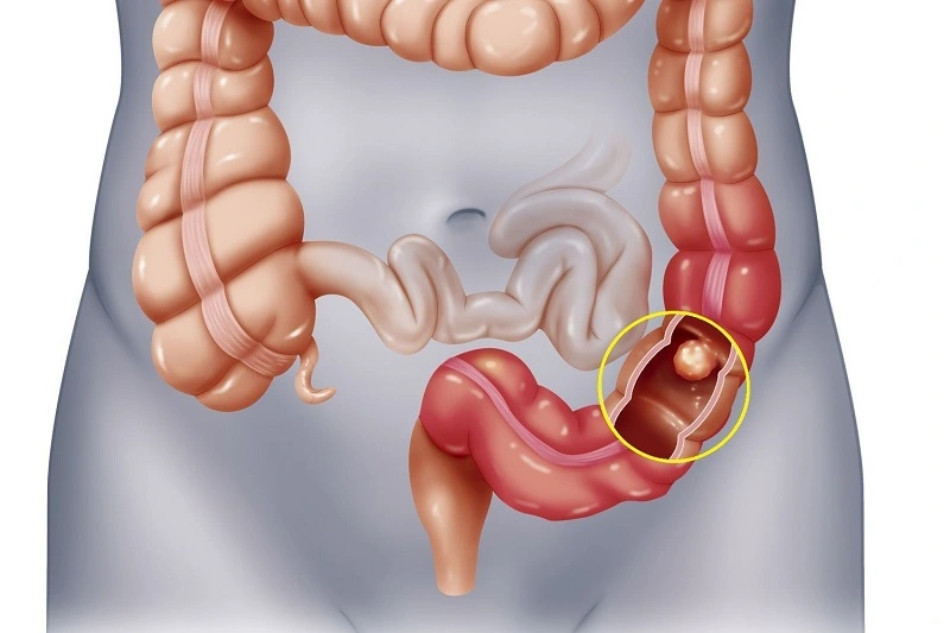 Trà Gạo Lứt: 12 Tác Dụng Tuyệt Vời Đối Với Sức Khỏe