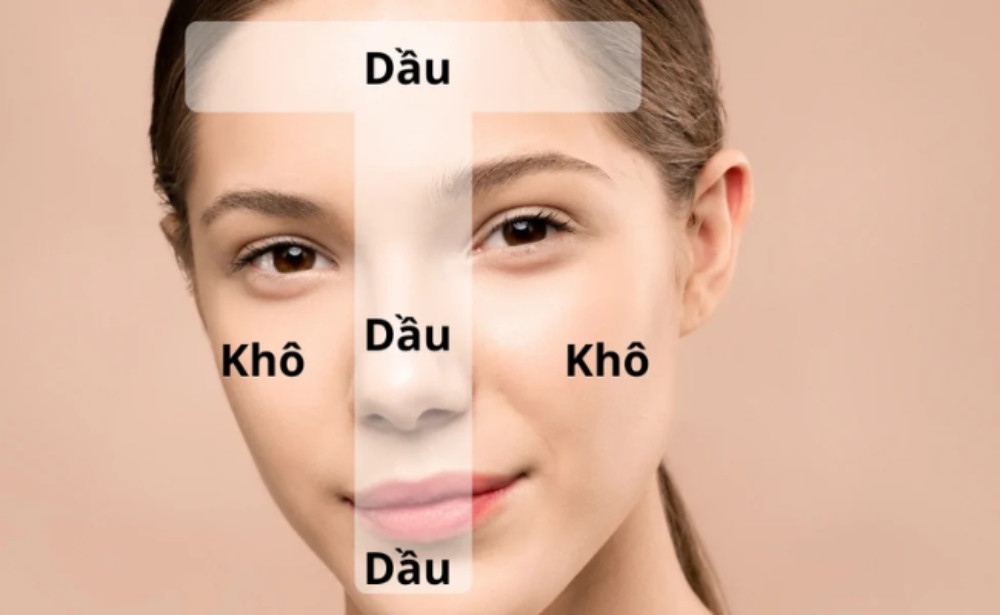 Vùng chữ T trên mặt: Bí quyết chăm sóc da hiệu quả