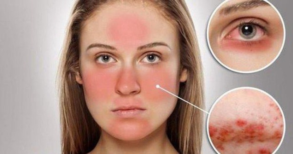 Vùng chữ T trên mặt: Bí quyết chăm sóc da hiệu quả